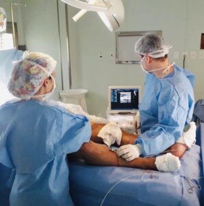 endolaser